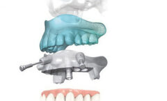 tecnodental ortodonzia laboratorio